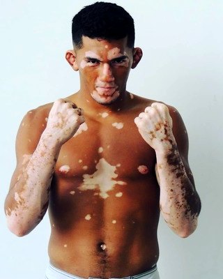 Melquizael Costa